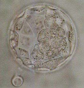 This is an actual picture of our embryo!  This picture was taken today; before it was transferred back! It is starting to hatch as you can see on the left side of the picture.  